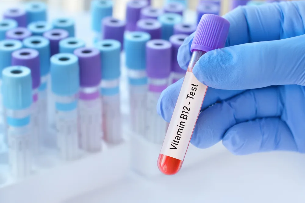Rilevazione della carenza di vitamina B12 tramite esame del sangue